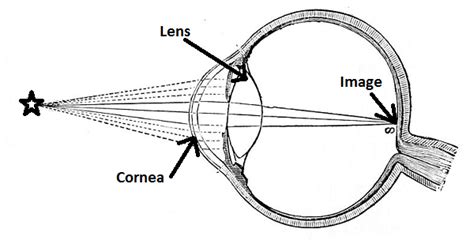 ophthalmic refractometer definition